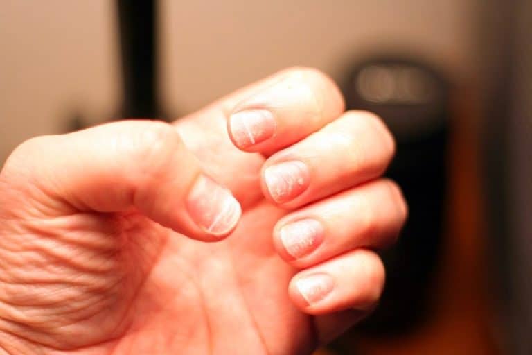 How to Get Healthy Fingernails After Removing Acrylic Fake Nails